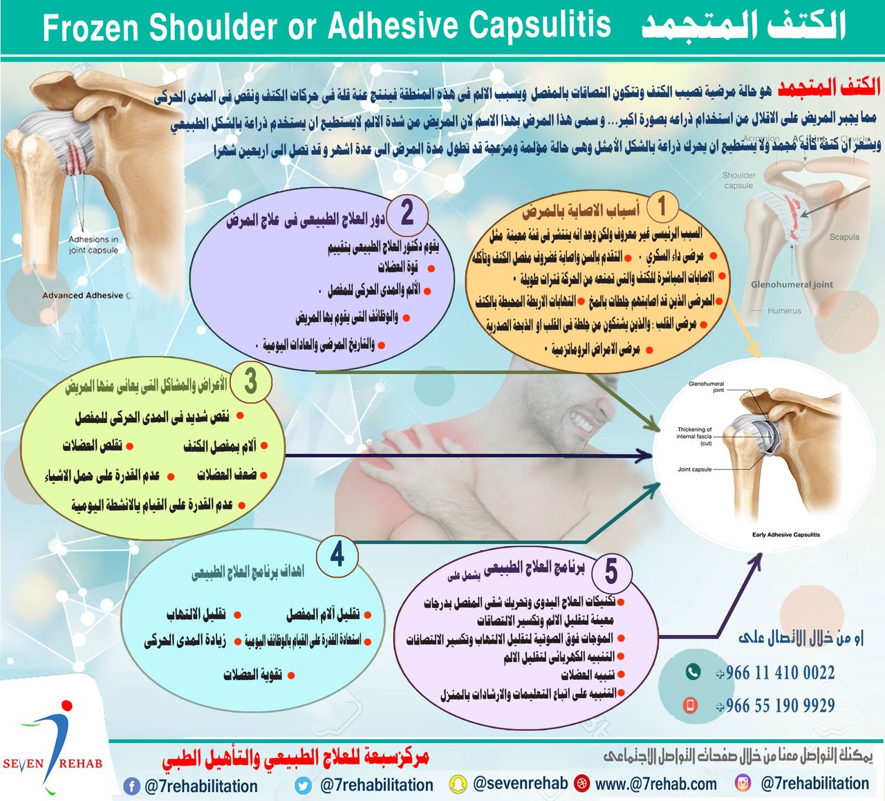 الكتف المتجمد Frozen Shoulder