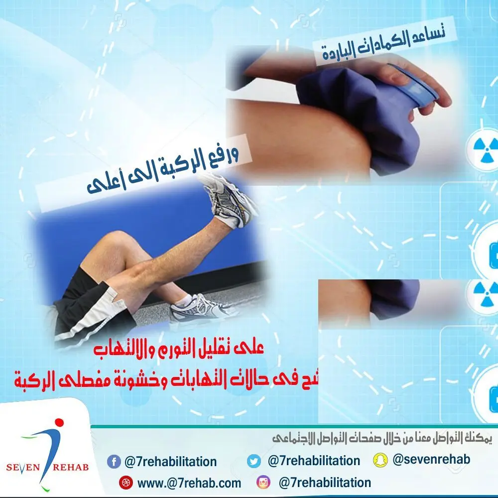 الكمادات الباردة ورفع الركبة لتقليل التورم والالتهاب في إصابات الغضروف الهلالي