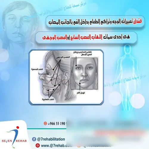 فقدان تعبيرات الوجه وتراكم الطعام بداخل الفم بالجانب المصاب هى احدى  التهاب العصب السابع (العصب الوجهى )