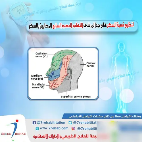تنظيم نسبة السكر هام جدا لمرضى التهاب العصب السابع المصابين بالسكر