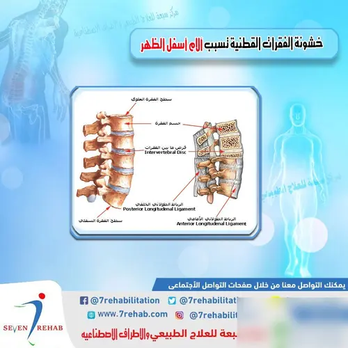 خشونة الفقرات القطنية تسبب آلام أسفل الظهر