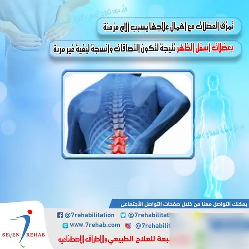 تمزق العضلات مع اهمال علاجها يسبب آلام مزمنة بعضلات أسفل الظهر نتيجة لتكون التصاقات وأنسجة ليفية غير مرنة