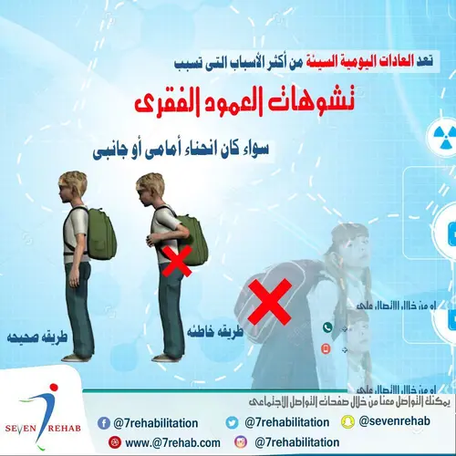 تعد العادات اليومية السيئة من أكثر الأسباب التى تسبب تشوهات العمود الفقرى سواء كان انحناء أمامى أو جانبى