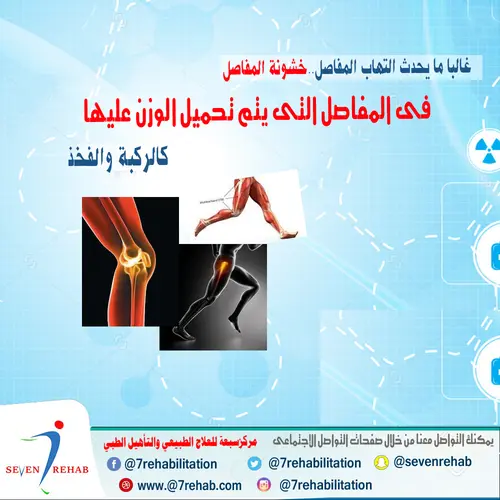 العلاج الطبيعى وتقليل الوزن وتصحيح العادات السيئة يساعد فى تقليلل آلام التهاب المفاصل