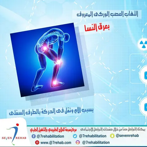 التهاب العصب الوركى المعروف بعرق النسا يسبب آلام وثقل فى الحركة بالطرف السفلى