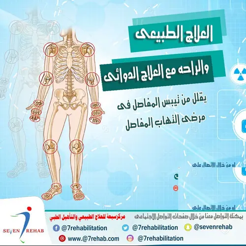 العلاج الطبيعى والراحة مع العلاج الدوائى يقلل من تيبس المفاصل فى مرضى التهاب المفاصل