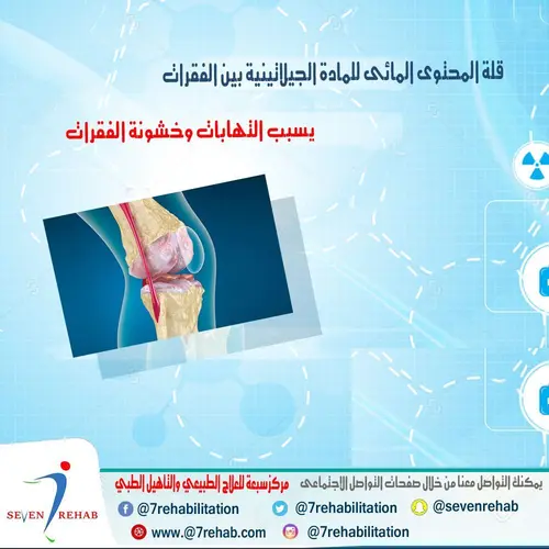 قلة المحتوى المائى للمادة الجيلاتينية بين الفقرات يسبب التهابات وخشونة الفقرات