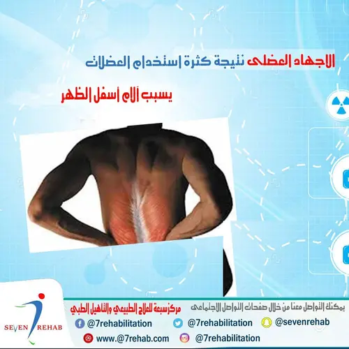 الاجهاد العضلى نتيجة كثرة استخدام العضلام يسبب آلام أسفل الظهر