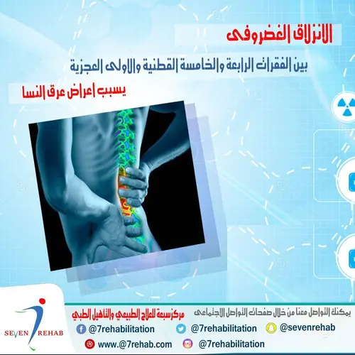الانزلاق الغضروفى بين الفقرات الرابعة والخامسة القطنية والاولى العجزية  يسبب اعراض عرق النسا