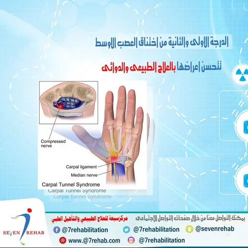 الدرجة الاولى والثانية من اختناق العصب الاوسط تتحسن اعراضها بالعلاج الطبيعى والدوائى