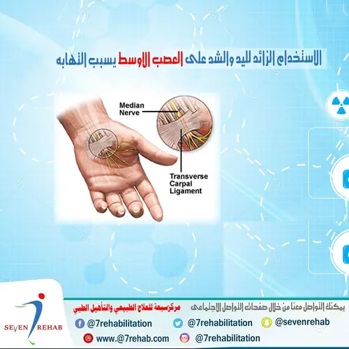 الاستخدام الزائد لليد والشد على العصب الاوسط يسبب التهابه