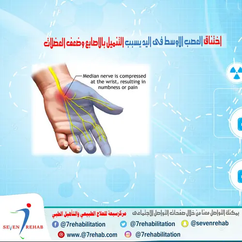 قد تصاب السيدات الحوامل بالتهابات العصب الاوسط