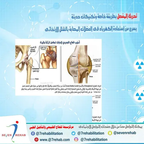 الاتهاب هو رد فعل طبيعى من الجسم وهو مؤشر يحركك للعلاج لان  من علاماته الالم