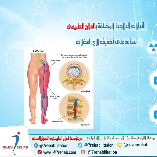المرحلة التى تلى الشلل الارتخائى فى حالات جلطات المخ هى الشلل التصلبى وفيها تزيد الكهرباء بالعضلات وللعلاج الطبيعى دور حيوى لهذه المرحلة